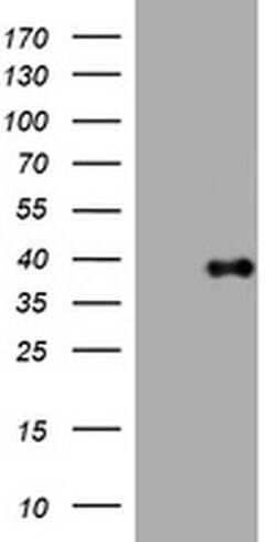 Invitrogen PIK3C2A Monoclonal Antibody (OTI2C2) 100 &mu;L | Buy Online | Invitrogen&trade; | Fisher Scientific
