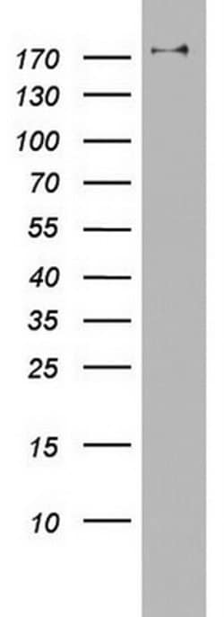 Invitrogen PIK3C2A Monoclonal Antibody (OTI2C2) 100 &mu;L | Buy Online | Invitrogen&trade; | Fisher Scientific
