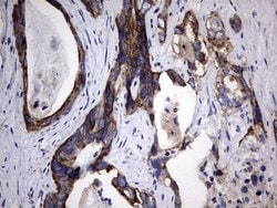 Invitrogen PIK3CD Monoclonal Antibody (OTI6A12) 100 &mu;L; Unconjugated:Antibodies,