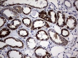 Invitrogen PIK3CD Monoclonal Antibody (OTI6A12) 100 &mu;L; Unconjugated:Antibodies,