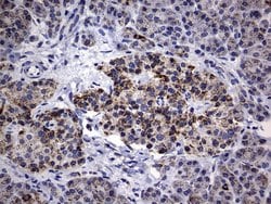 Invitrogen PIK3CD Monoclonal Antibody (OTI6A12) 100 &mu;L; Unconjugated:Antibodies,