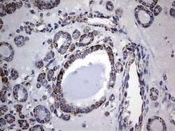 Invitrogen PIK3CD Monoclonal Antibody (OTI6A12) 100 &mu;L; Unconjugated:Antibodies,