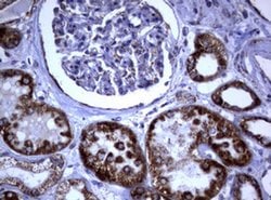 Invitrogen PIK3CD Monoclonal Antibody (OTI2D9) 100 &mu;L; Unconjugated:Antibodies,