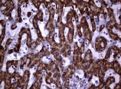 Invitrogen PIK3CD Monoclonal Antibody (OTI2D9) 100 &mu;L; Unconjugated:Antibodies,