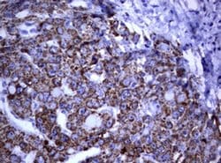 Invitrogen PIK3CD Monoclonal Antibody (OTI2D9) 100 &mu;L; Unconjugated:Antibodies,