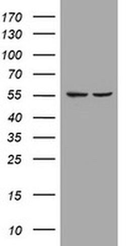Invitrogen PIK3CD Monoclonal Antibody (OTI2D9) 100 &mu;L; Unconjugated:Antibodies,