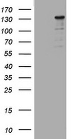 Invitrogen ZEB2 Monoclonal Antibody (OTI1E12) 100 &mu;L; Unconjugated:Antibodies,