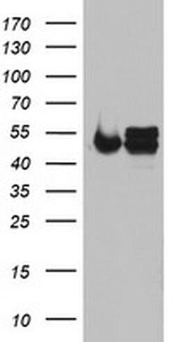 Invitrogen NDUFS2 Monoclonal Antibody (OTI2G2) 100 &mu;L; Unconjugated:Antibodies,