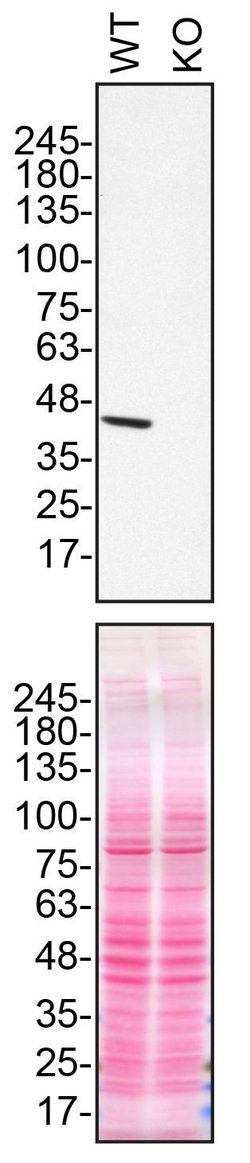 Invitrogen NDUFS2 Monoclonal Antibody (OTI2G2) 100 &mu;L; Unconjugated:Antibodies,