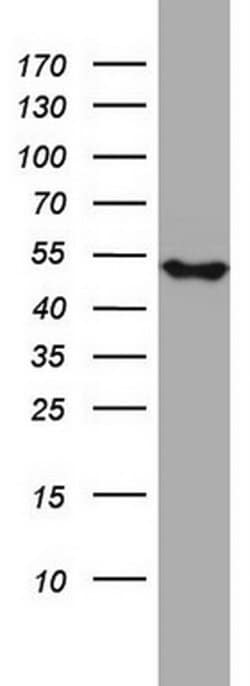 Invitrogen NDUFS2 Monoclonal Antibody (OTI2G2) 100 &mu;L; Unconjugated:Antibodies,