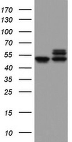 Invitrogen NDUFS2 Monoclonal Antibody (OTI1D5) 100 &mu;L; Unconjugated:Antibodies,