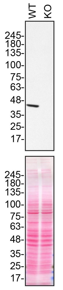 Invitrogen NDUFS2 Monoclonal Antibody (OTI1D5) 100 &mu;L; Unconjugated:Antibodies,