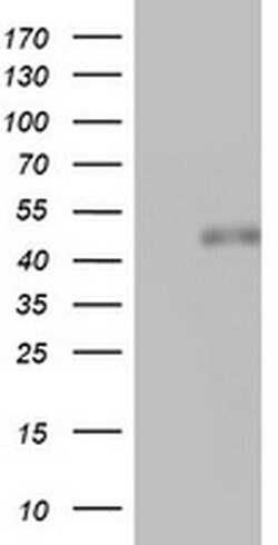 Invitrogen SPATA2L Monoclonal Antibody (OTI3F6) 100 &mu;L | Buy Online | Invitrogen&trade; | Fisher Scientific