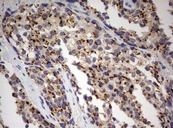 Invitrogen PARN Monoclonal Antibody (OTI1G7) 100 &mu;L | Buy Online | Invitrogen&trade; | Fisher Scientific