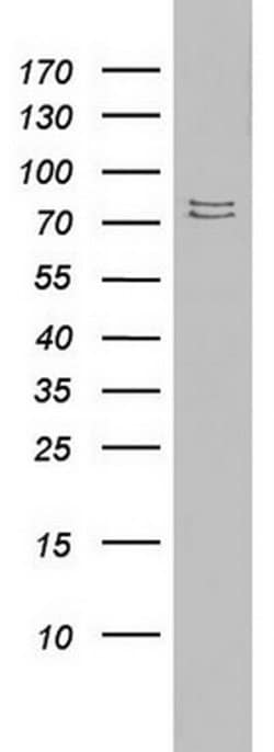 Invitrogen PARN Monoclonal Antibody (OTI1G7) 100 &mu;L | Buy Online | Invitrogen&trade; | Fisher Scientific