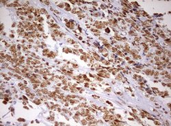 Invitrogen DDX56 Monoclonal Antibody (OTI2E5) 100 &mu;L; Unconjugated:Antibodies,