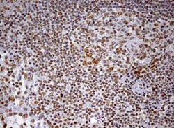 Invitrogen DDX56 Monoclonal Antibody (OTI2E5) 100 &mu;L; Unconjugated:Antibodies,