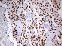 Invitrogen DDX56 Monoclonal Antibody (OTI2E5) 100 &mu;L; Unconjugated:Antibodies,