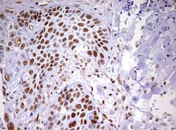 Invitrogen DDX56 Monoclonal Antibody (OTI2E5) 100 &mu;L; Unconjugated:Antibodies,