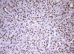 Invitrogen DDX56 Monoclonal Antibody (OTI2E5) 100 &mu;L; Unconjugated:Antibodies,
