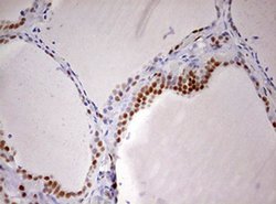 Invitrogen DDX56 Monoclonal Antibody (OTI2E5) 100 &mu;L; Unconjugated:Antibodies,