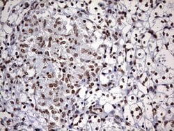 Invitrogen DDX56 Monoclonal Antibody (OTI5C1) 100 &mu;L; Unconjugated:Antibodies,
