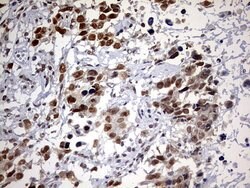 Invitrogen DDX56 Monoclonal Antibody (OTI5C1) 100 &mu;L; Unconjugated:Antibodies,