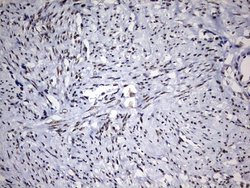 Invitrogen DDX56 Monoclonal Antibody (OTI5C1) 100 &mu;L; Unconjugated:Antibodies,