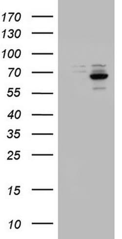 Invitrogen DDX56 Monoclonal Antibody (OTI5C1) 100 &mu;L; Unconjugated:Antibodies,