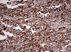 MRPS11 Monoclonal Antibody (OTI3D2):Antibodies, Monoclonal