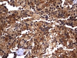 Invitrogen CK1 gamma-2 Monoclonal Antibody (OTI4H3) 100 &mu;L; Unconjugated:Antibodies,
