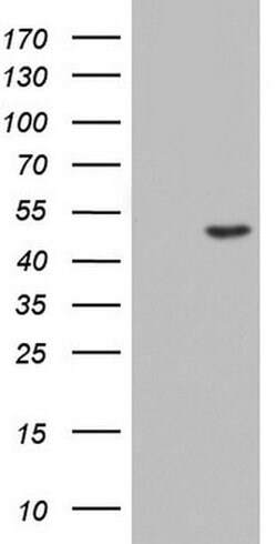 Invitrogen CK1 gamma-2 Monoclonal Antibody (OTI4H3) 100 &mu;L; Unconjugated:Antibodies,