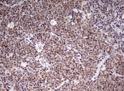 Invitrogen CDCA7L Monoclonal Antibody (OTI1A12) 100 &mu;L; Unconjugated:Antibodies,