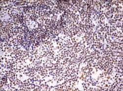 Invitrogen CDCA7L Monoclonal Antibody (OTI1A12) 100 &mu;L; Unconjugated:Antibodies,