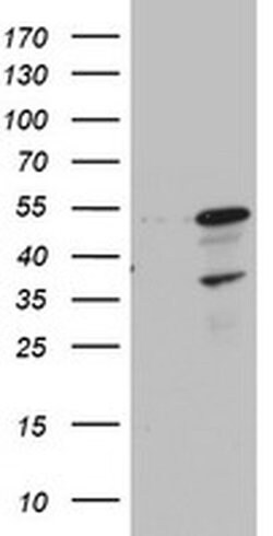 Invitrogen CDCA7L Monoclonal Antibody (OTI1A12) 100 &mu;L; Unconjugated:Antibodies,