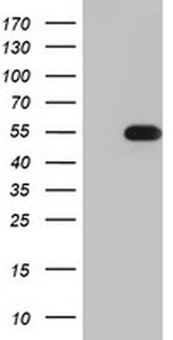Invitrogen TIPIN Monoclonal Antibody (OTI2E6) 100 &mu;L | Buy Online | Invitrogen&trade; | Fisher Scientific