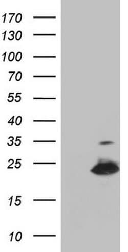 Invitrogen MRPS11 Monoclonal Antibody (OTI3B1) 100 &mu;L; Unconjugated:Antibodies,