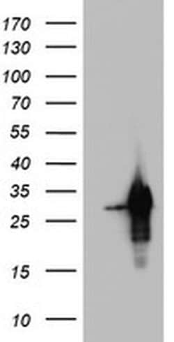 Invitrogen PRRX1 Monoclonal Antibody (OTI2B2) 100 &mu;L; Unconjugated:Antibodies,