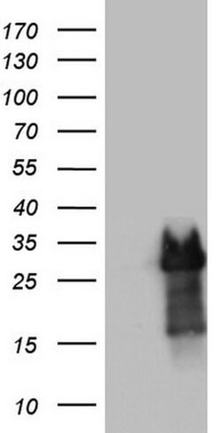 Invitrogen PRRX1 Monoclonal Antibody (OTI6A4) 100 &mu;L; Unconjugated:Antibodies,