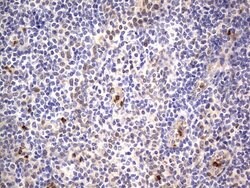 Invitrogen PRRX1 Monoclonal Antibody (OTI1E10) 100 &mu;L | Buy Online | Invitrogen&trade; | Fisher Scientific