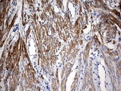 Invitrogen KLHL12 Monoclonal Antibody (OTI4E1) 100 &mu;L; Unconjugated:Antibodies,