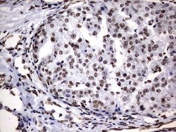 Invitrogen DDX56 Monoclonal Antibody (OTI11H7) 100 &mu;L; Unconjugated:Antibodies,