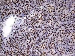 Invitrogen DDX56 Monoclonal Antibody (OTI11H7) 100 &mu;L; Unconjugated:Antibodies,