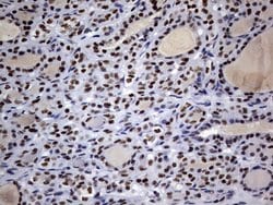 Invitrogen DDX56 Monoclonal Antibody (OTI11H7) 100 &mu;L; Unconjugated:Antibodies,
