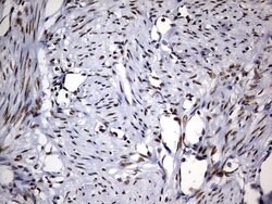 Invitrogen DDX56 Monoclonal Antibody (OTI11H7) 100 &mu;L; Unconjugated:Antibodies,