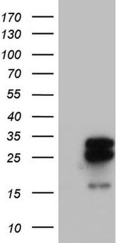Invitrogen MRPS7 Monoclonal Antibody (OTI5E11) 100 &mu;L; Unconjugated:Antibodies,