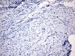 Invitrogen IL-20 Monoclonal Antibody (OTI2B1) 100 &mu;L; Unconjugated:Antibodies,
