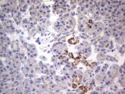 Invitrogen CHCHD3 Monoclonal Antibody (OTI7G4) 100 &mu;L; Unconjugated:Antibodies,