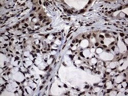Invitrogen Macro H2A.2 Monoclonal Antibody (OTI1F6) 100 &mu;L; Unconjugated:Antibodies,