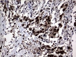 Invitrogen Macro H2A.2 Monoclonal Antibody (OTI1F6) 100 &mu;L; Unconjugated:Antibodies,